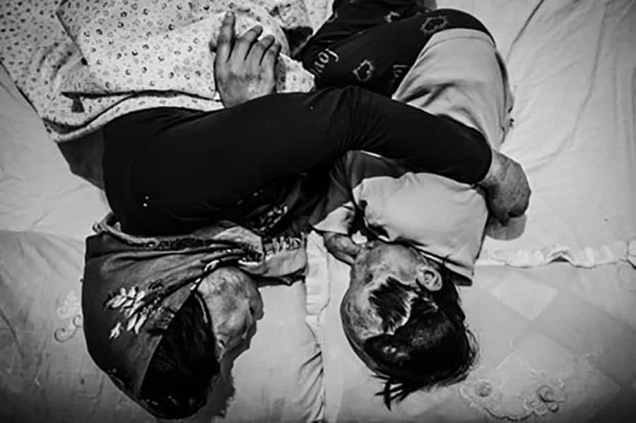 از مجموعهی «قربانیان عشق اجباری» (اسیدپاشی) − عکاس: ابراهیم نوروزی