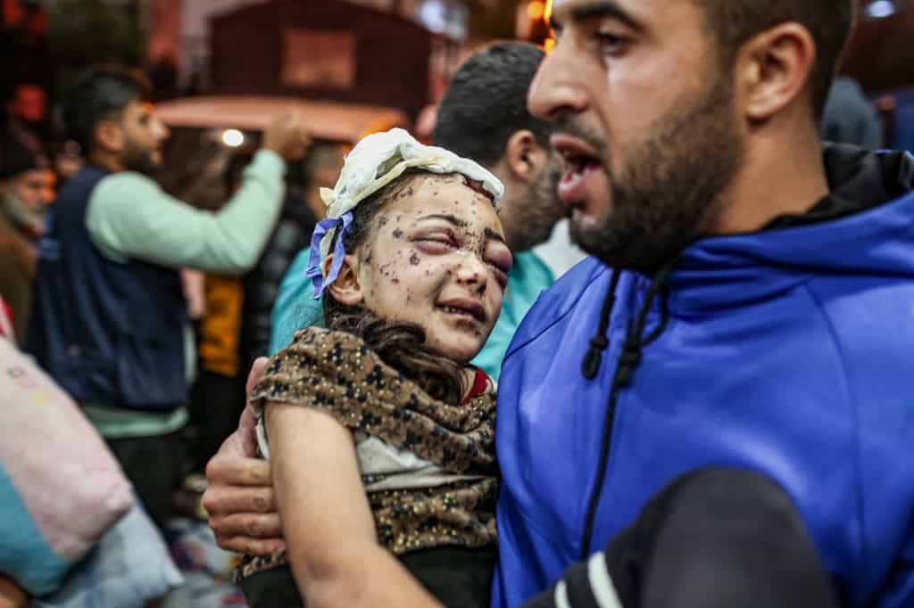 ۲۰ نوامبر ۲۰۲۳، یک کودک مجروح فلسطینی را از بیمارستان اندونزیایی غزه خارج میکنند.