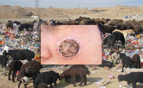 زخم بیماری پوستی لیشمانیازیس بر صورت – متن تصویر: دامداری در حاشیه شهر پیشوا؛ چرا در زبالهدانی