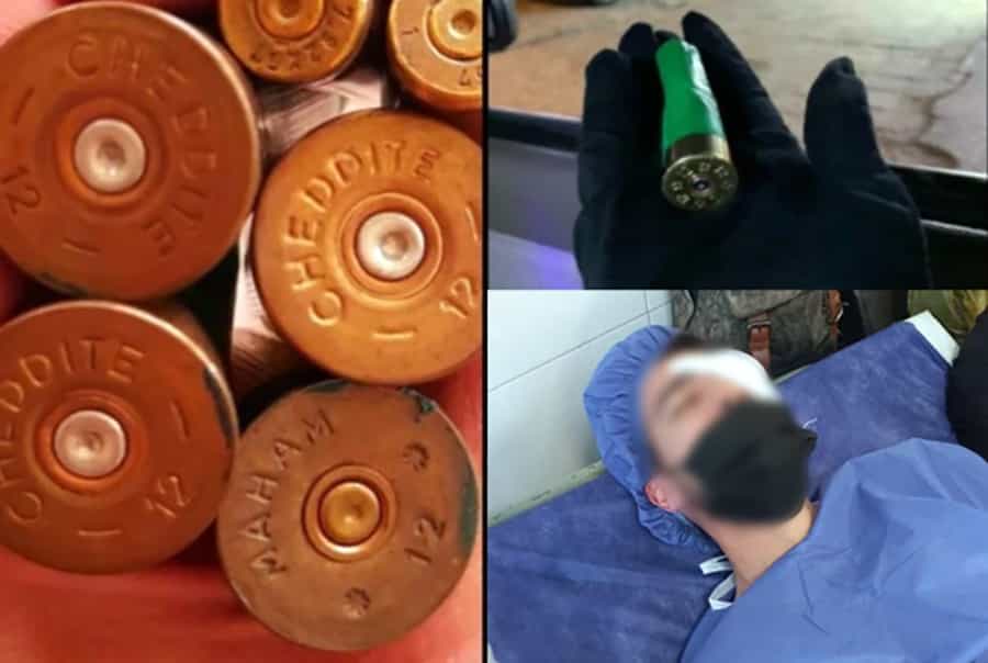 نابینا شدن تعداد کثیری از معترضان در اثر اصابت ساچمه و پینتبال (آبان، آذر ۱۴۰۱)