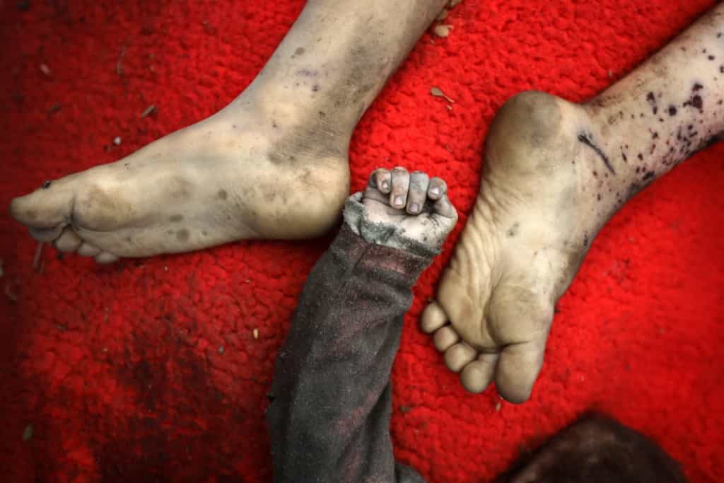اجساد دو کودک فلسطینی که در حمله هوایی اسرائیل به شمال غزه کشته شدهاند، در محوطه بیمارستان الشفاء در شهر غزه