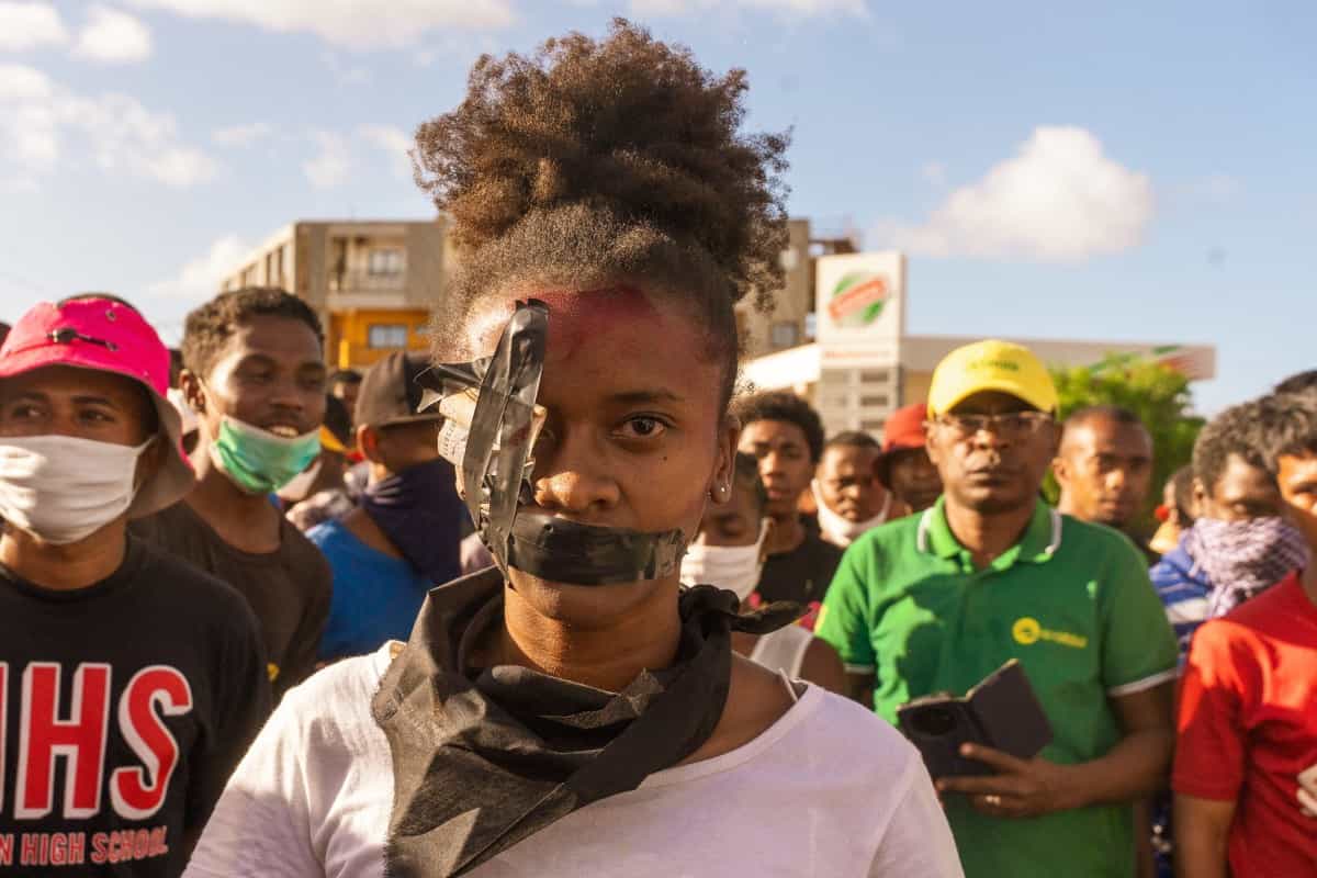 یک معترض در حالی که در یک راهپیمایی در آنسیرانانا در ۱۰ اکتبر ۲۰۲۵ خواستار اصلاحات قانون اساسی و استعفای رئیس جمهور آندری راجوئلینا بود، چسب روی دهان و یک چشم خود زده است.