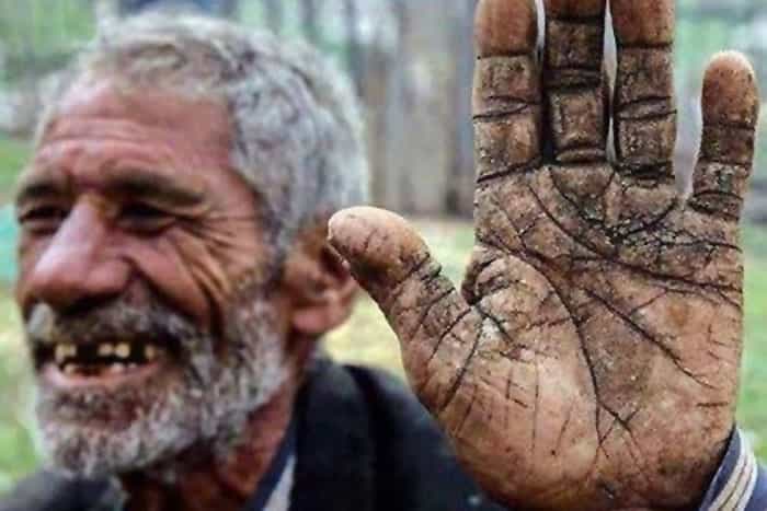 یک کارگر سالمند دست پینهبسته خود را جلوی دوربین گرفته و میخندد. او چند دندان ندارد.